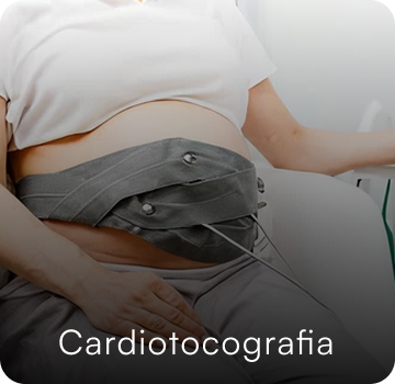 imagem de um cardiotocografia