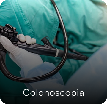 imagem de um colonoscopia